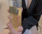 Collects and releases 3 doses of pee from applying pediatric urine collector