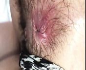 HAIRY ASSHOLE FETISH COLLECTION #3 NASTY ANAL GAPE from natalieflowers anal gape