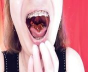 Asmr Eating Jelly Bears With Braces by Arya Grander from mmd giant girl vore