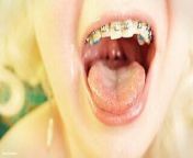 eating in braces - vore and food fetish - close up video from arya lip kiss