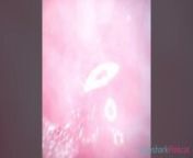 Camera inside Vagina after internal Creampie EP2 from bameka