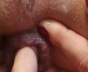 First prolapse of my ass Anal fisting that makes me squirt Anal fingering Red rose from roja pussy images comboo pedomom son 3d